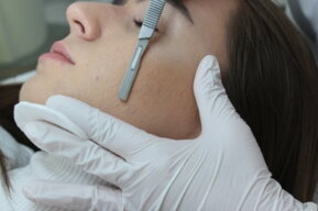 Dermaplaning