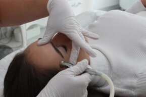 Microdermabrasion