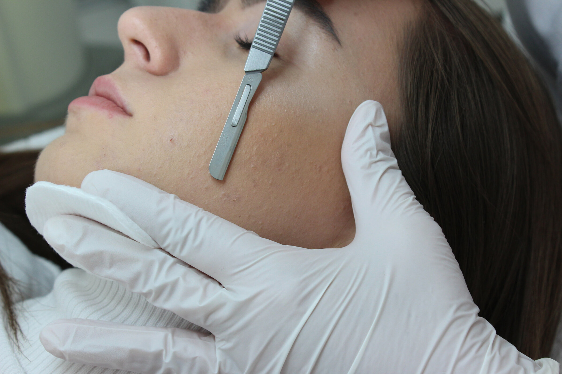 Dermaplaning bei Fachkosmetikerin Ildikó Nechansky